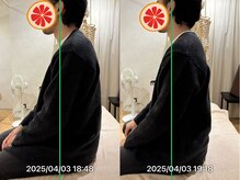 グレフル鍼灸接骨院 整体院 心斎橋/