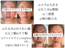 テディビューティーケア(TEDDY beauty care)の雰囲気（お悩みに合わせたアプローチで改善をいたします♪）