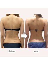 じぶんdeエステ 新宿店/別人級の背中へ