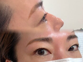 ツキ(tsuki.)/【ケラチンラッシュリフト】