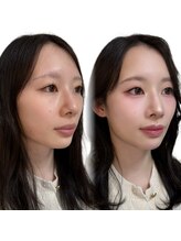 メゾンカラクル/メイクビフォーアフター