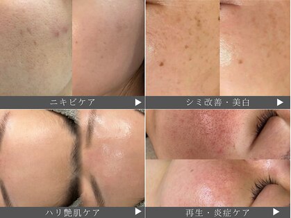 アエ メゾン(ae maison)の写真