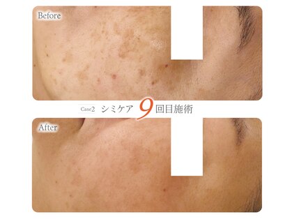 オービーエム 博多阪急店(O.B.M)の写真