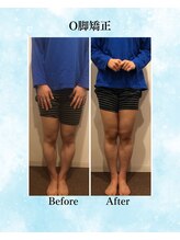 コア カイロプラクティック 錦糸町/ビフォーアフター　錦糸町/亀戸