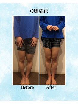 コア カイロプラクティック 錦糸町/ビフォーアフター 錦糸町/亀戸