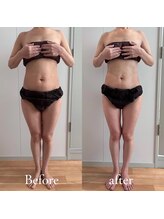 スリラ(SuriLa)/◆ビフォーアフター◆