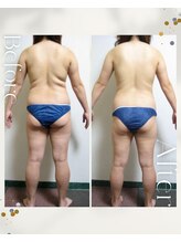 エスティ イオ(io)/ビフォーアフター