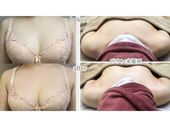 ビオラ(美ola)の写真/【薄着になる前に】鎖骨下痩せ・下垂・左右差を背中から整え美バストへ♪