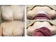 ビオラ(美ola)の写真/【薄着になる前に】鎖骨下痩せ・下垂・左右差を背中から整え美バストへ♪
