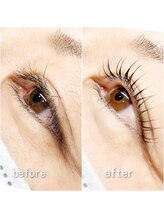 イツミ ヘアーループ(itsumi)/コスメリフト