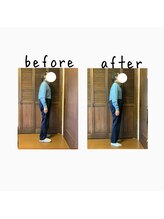 コリラ/施術前後