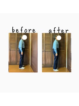 コリラ/施術前後