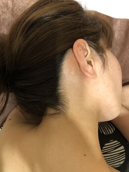 リュミエール(lash&brow lumiere)/大人気うなじ脱毛