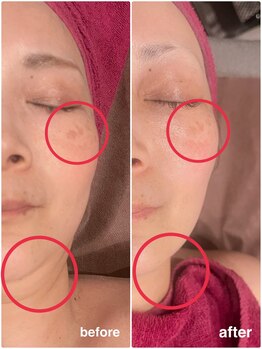 ソルエユニーク(Le seul et unique)/シミケア・リフトアップ効果★