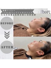 ルーナ(LUNA)/即日リフトアップ☆