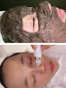 ビューティスタジオ韓美 いわき店の写真/毛穴汚れ/毛穴の開き対策◎大人気の毛穴洗浄で美容大国である韓国の水光肌を叶える☆毛穴レスなツヤ美肌♪