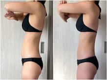 インプルーブ 浜北店(Improve)/筋肉を付けることで、反り腰改善