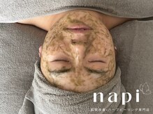 ナピ(napi)