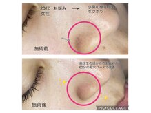 チャームプラス(CHARM+)の雰囲気（【憧れの毛穴レス】頑固な毛穴汚れはプロにお任せください！）