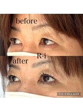 アールアイ(R-i)/アイリッドアップパーマ+BF