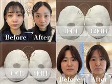 R-1ビューティーサロン 表参道