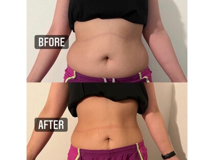 寝るジム for yuu(寝るジム フォーユー)の写真