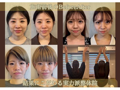 ココロ美容整体院(cocoro)の写真