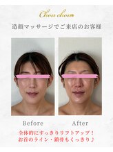 シュシュ(Chouchou)/小顔造顔マッサージ