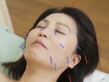 鍼灸院 萌/美容鍼・フェイシャル