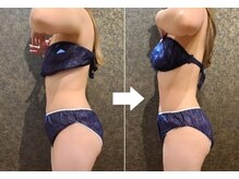 ワンルーム(1ROOM)/