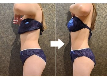 ワンルーム(1ROOM)/