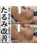 【リフトアップ】気になるたるみ・脂肪にアプローチでスッキリ！全顔×首