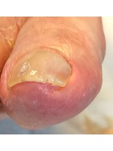 001 新横浜/突き刺さっていてもOKです