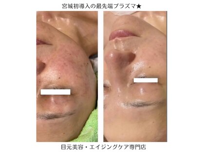 オリーブ(Olive)の写真