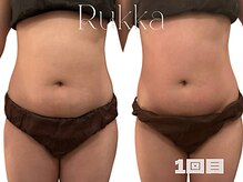 ルッカ(RUKKA)/【お腹】