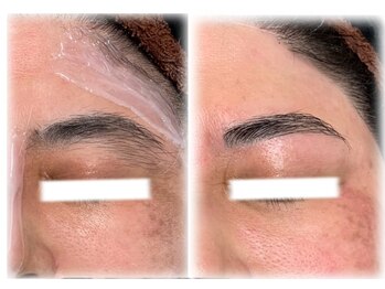 ブリリアンス(BRILLIANCE)/オススメ★鎮静＆保湿パック付