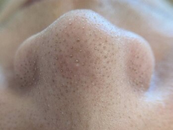 リセットプラス(Reset+)/