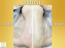 ヴェールブランシュ 町田(Vert Blanche)の雰囲気（【劇的結果】圧巻のビフォーアフターで身体&肌に更なる自信を♪）