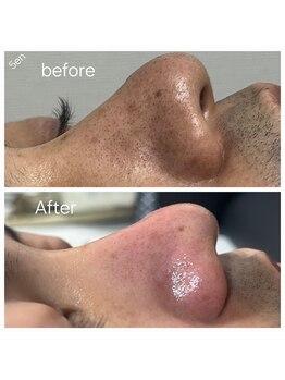 アールスサロン/