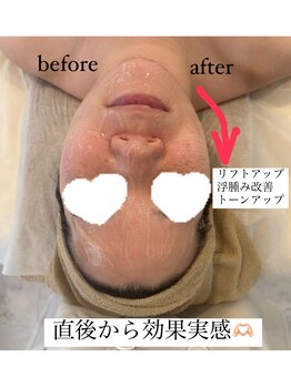 フェリチタ(felicita)/即効性エレクトロポレーション♪