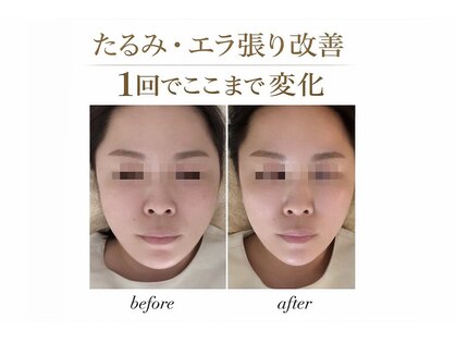 ピーエム(P.M)の写真