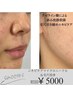 【ニキビ根本解決】毛穴洗浄+美白殺菌成分アゼライン導入　　￥6000→￥5000