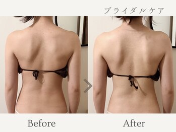 エミィ(emmy)の写真/人生最高の日を、美しい背中で迎える。