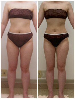 ソワンマリア(soin Maria)/1ヶ月の効果♪