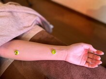 アルバ暁子鍼灸治療院(alba暁子鍼灸治療院)/初めての方にもおすすめ♪