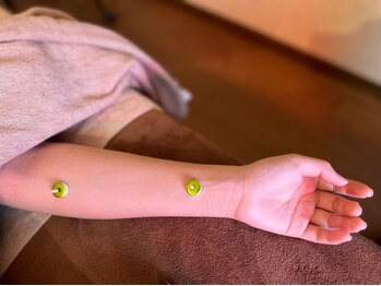 アルバ暁子鍼灸治療院(alba暁子鍼灸治療院)/初めての方にもおすすめ♪