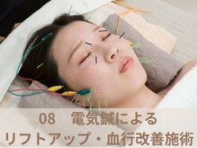 オムリス鍼灸接骨院/美容鍼の流れ　オムリス/駒込店