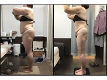 リッツ 大宮店/【Before/After】痩身