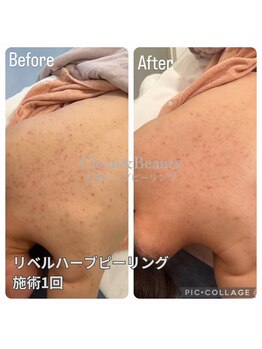 クリーンアンドビューティ 札幌(Clean&Beauty)/1度で変化は当たり前のサロン♪