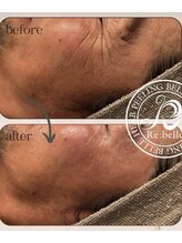 エヌ スタイル(N Style)/リベルハーブピーリング 